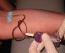 blood draw